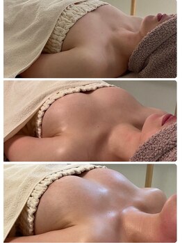 サロン アイミー(salon i me)/【バストアップ】症例