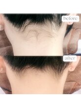 ポノ(PONO)/うなじ襟足は当店にお任せ！