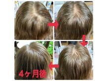 ピーチ グリーン(Peach green)の雰囲気（スカルプケアも大人気です！ご自身の大切な髪を元気にしたい方！）