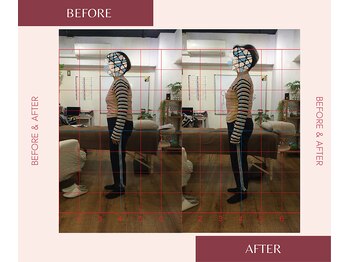 整体院 來花 福岡薬院店(KOHANA)/首肩こり・腰痛のお悩み