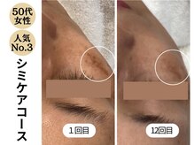 ディレイア ザ コスメ 有楽町マルイ店(direia the cosme)/シミ/くすみ/月1～2回［有楽町］