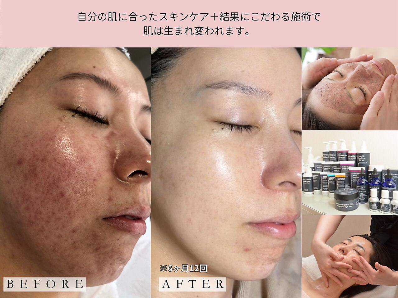 レディラック 大阪梅田本店(Lady Luck)｜ホットペッパービューティー