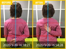 整体院 元 くまなん店/【60代女性】巻き肩、姿勢改善