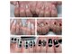 キッカネイル バイ プーパ 花園店(chicca nail by pupa)の写真