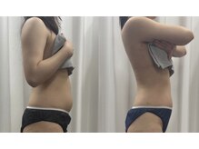 ラサロンホープ 西麻布(La.SALON HOPE)/