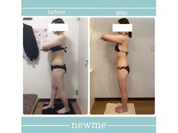 ニュウミー 諏訪本店(newme)/お客様ビフォーアフター