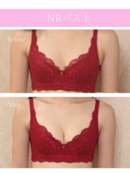 ココロ(COCORO)/諦めないバストのお悩み