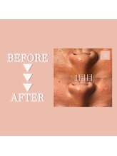 クリアラボ 豊中(Clear Lab)/Before&After