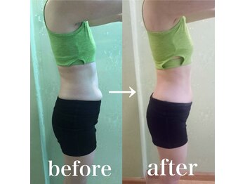 スパチャーレ(Spa ciare)/【トーンヌール】before&after