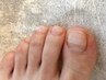 【Foot/巻き爪ケア】B/Sブレイスクイック 片足1本