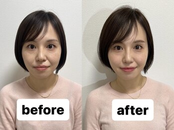 ミルク 池袋(MILK)/お客様before→after