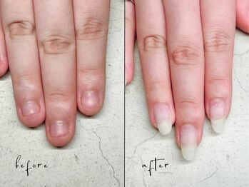 ユユネイル(yuyu nail)/【深爪育成】