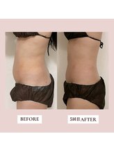 ミーティス/術後ケアのお客様♪