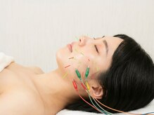 もり鍼灸整骨院 今出川マッサージ治療院の雰囲気（アロマ/リンパ/京都市上京区北区/整骨院/整体/美容鍼灸）