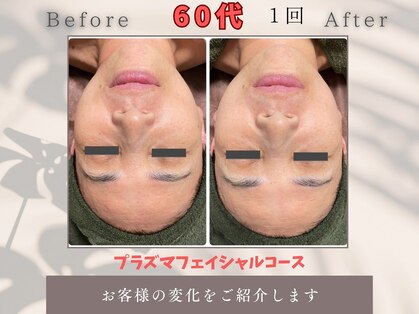 トータルビューティー雅の写真