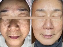 スパ アールアンドビー(SPA*R&B)