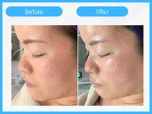 トウメイコガオ 横浜店/トウメイコガオでハーブ