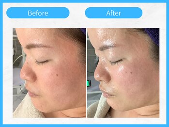 トウメイコガオ 横浜店/トウメイコガオでハーブ