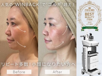 ビオスパ(BioSpa)の写真