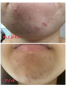 サロンドール(SalonDoll)/落とすケアを見直すと...