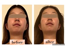 マンダ 田町(Manda)/優しくソフトな整体の小顔矯正◎