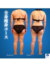 リアン(Lian)/【肩周りもスッキリしたい方】