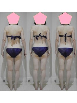 アルマ 芦屋(ALMA)/半月でもこんなに変わる!