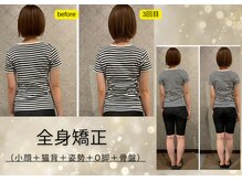 プルーム 久留米店(plume)/全身矯正