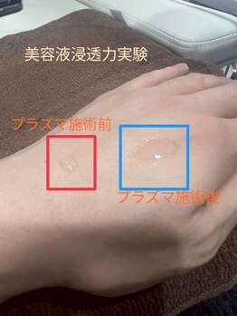ケンビラク(Kenbiraku 健美楽)/プラズマシャワー美容液浸透実験