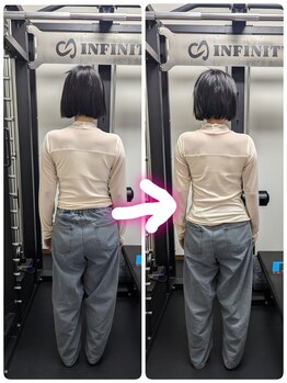 松葉整骨院/歪み　側湾