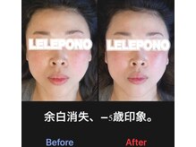 美容矯正サロン レレポノ(LELEPONO)/