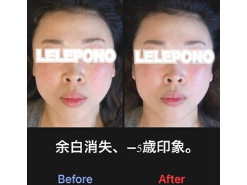 美容矯正サロン レレポノ(LELEPONO)/