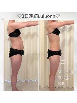 ヨサパーク ユアン(YOSA PARK yuann)の写真/結果重視◎溜め込み脂肪を撃退!結果にこだわる根本改善痩身でキレイで健康的な美ボディに♪