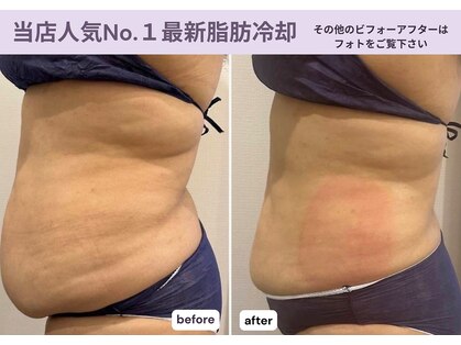 ビュウナ 銀座(BEAUNA)の写真