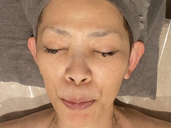 ラルミエール 緑店はなれ(la lumiere)/肌質改善!リゼネレート