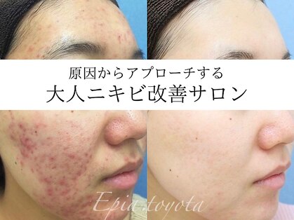 エピア 豊田店(Epia)の写真