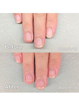 サロンペペ(salon pepe)/ジェルネイルで傷んだ爪