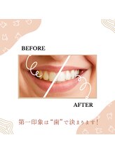 プラスビーセルフ(+b self)/第一印象は“歯”で決まります