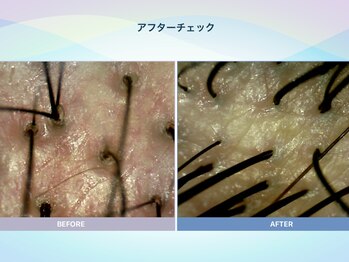 アンス(anth:)/お客様の仕上がり