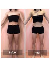 アヴィジョン(Avision)/