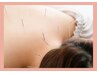 【つらい首肩こりの鍼】or【つらい腰痛の鍼】自律神経も調整　　￥5500
