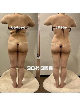 ソウソウビューティー 五反田(Shou Shou Beauty)/ビフォー★アフター　3回目