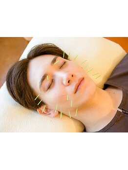 鍼灸施術を受けたい