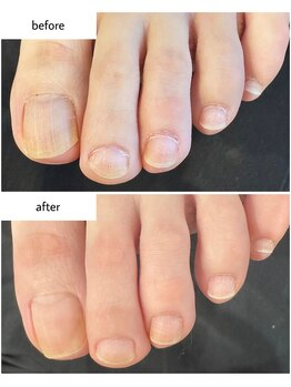 ケアプラス(care plus)/フットネイルケア