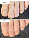 フットネイルケア