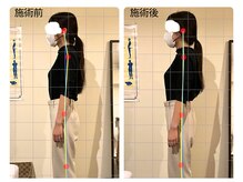 名古屋栄 肩こり腰痛専門整体 らーく/お客様のbefore、after