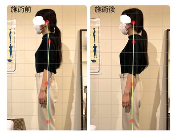 名古屋栄 肩こり腰痛専門整体 らーく/お客様のbefore、after