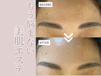 リボーン(Reborn)/ダクトピール１回