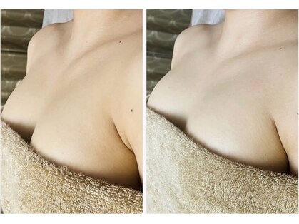 ビオラ(美ola)の写真