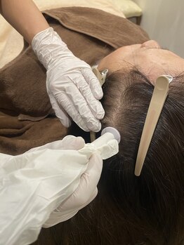 アランチャンティック(AlamCantik)/【プロセルセラピーズ施術事例】